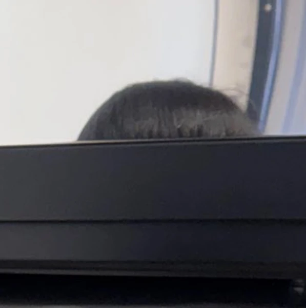 Today's Most Loved Go Won (Loossemble)