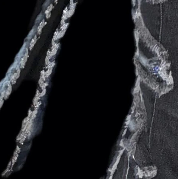 Best moment chosen by Choerry (ARTMS) fandom